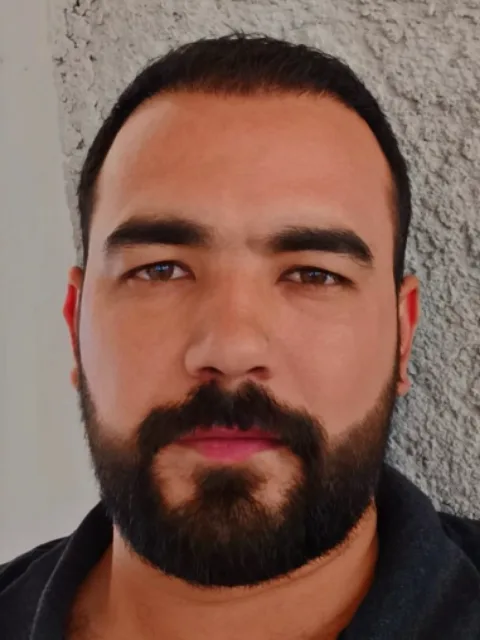 Gaziantep saç ekimi sonrası, vaka 2