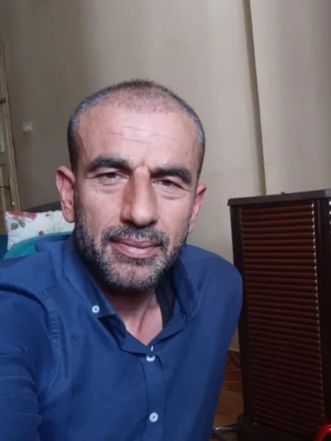 Gaziantep saç ekimi öncesi, vaka 3