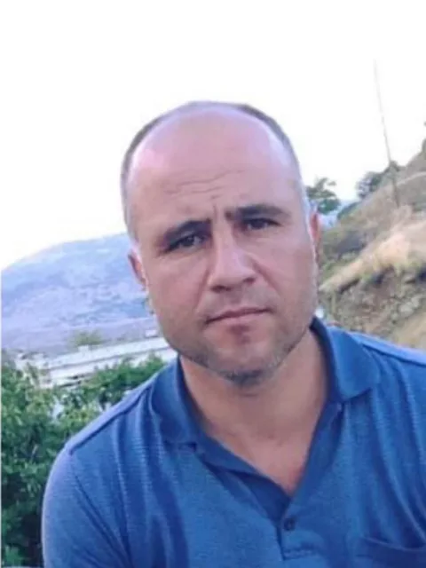 Gaziantep saç ekimi öncesi, vaka 4